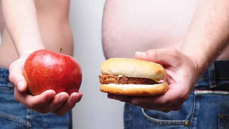 obesidad