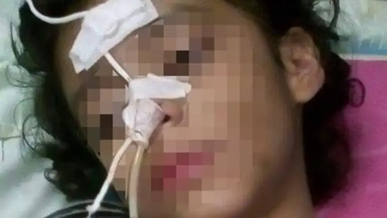 Niña golpeada por su madrastra