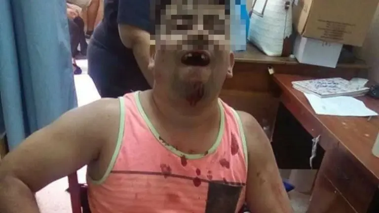 Motociclista accidentado