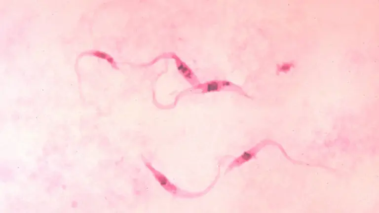 Flagelos de Trypanosoma cruzi bajo el microscopio