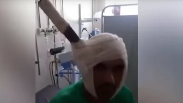 cabeza, hombre de brazil