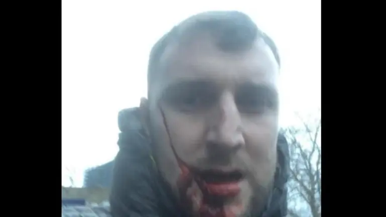 Aficionado herido