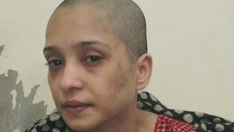 Mujer torturada en Pakistán