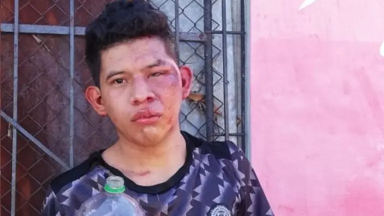 Ladrón golpeado en Ciudad Delgado