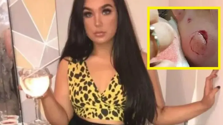 A mordidas a su amiga