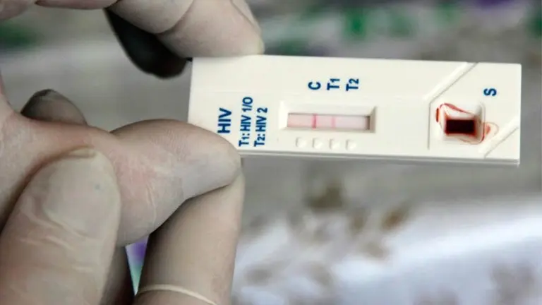 Prueba de VIH
