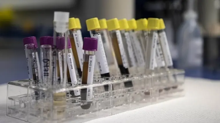 El coronavirus ataca más a este grupo sanguíneo