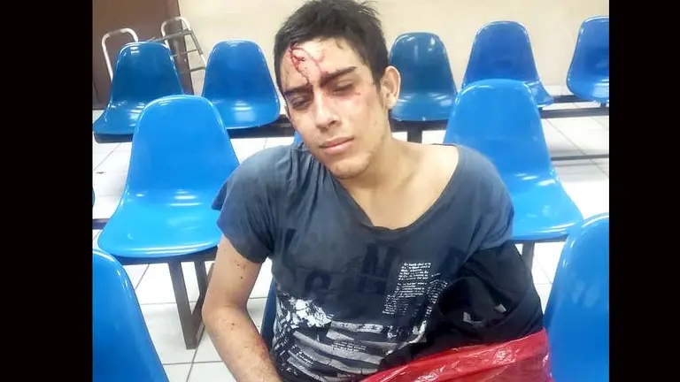 Fuga de reo en la unidad de Salud de Zacatecoluca Foto tomada de Viroleño Noticias