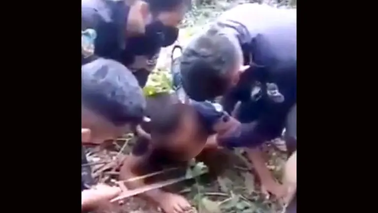 Menor con estaca en en su rosro 3