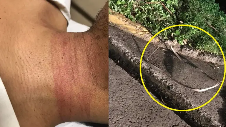 Joven atacado por indigente 1