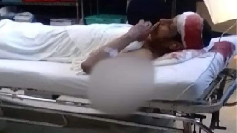 Pandillero atropellado