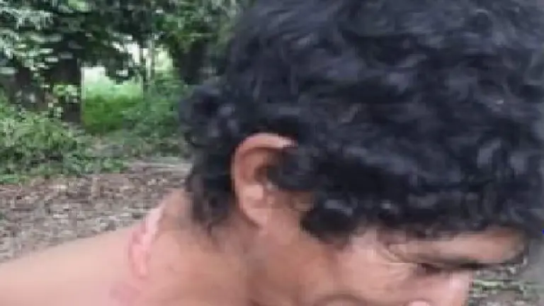 Intentó ahorcarse y ladró le robó el lazo