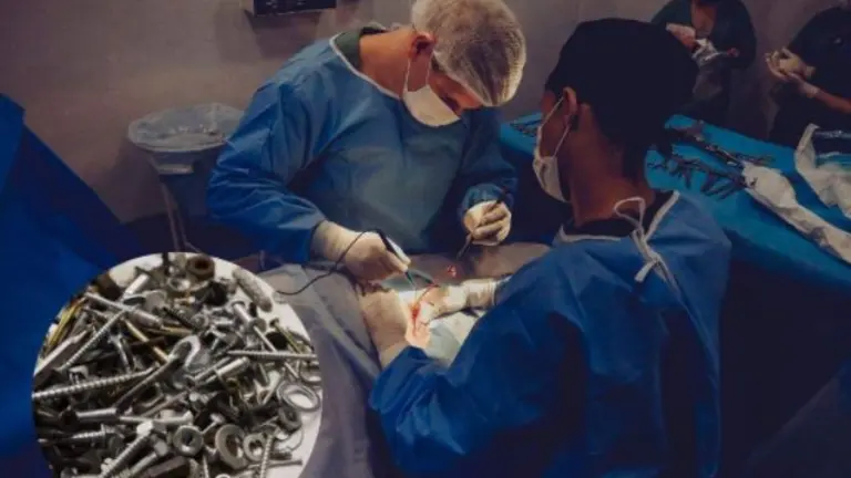 Clavos en el estómago