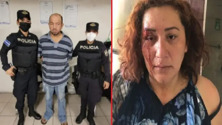La golpeó