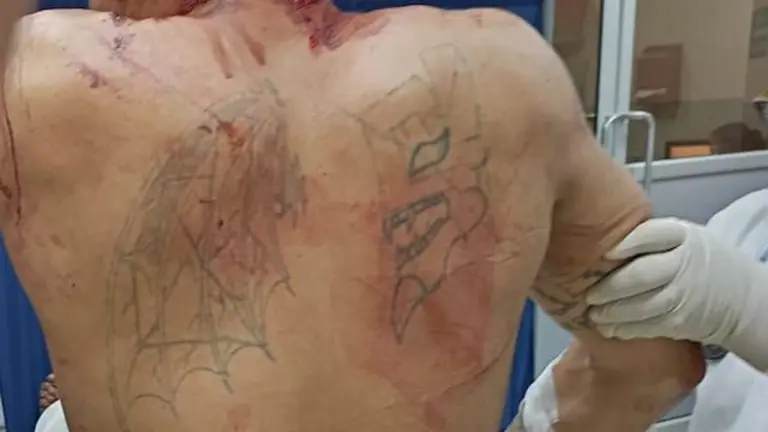 pandillero herido por sus compañeros