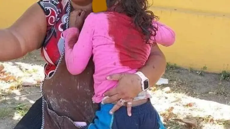 Niña mordida