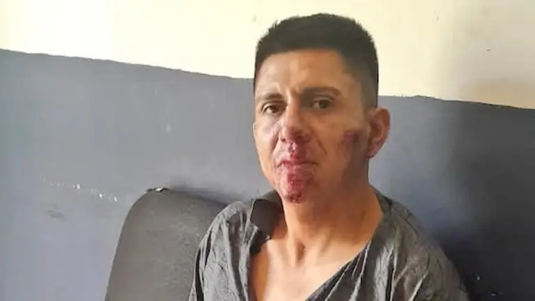 Manuel Antonio Calderón Avilés atropelló a dos personas mientras conducía en estado de ebriedad en la Troncal del Norte