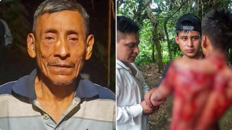 Saturnino González Gutiérrez, intento de homicidio