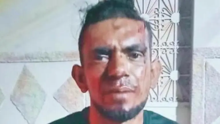 Edelmer José Pastora Rivera, lesiones o intento de homicidio 2