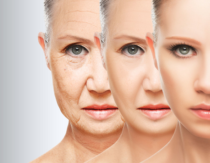 Menopausia