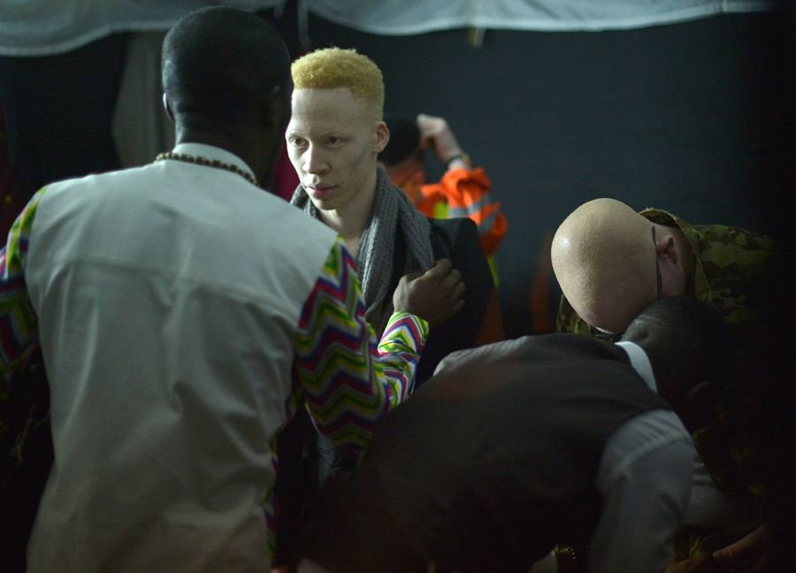albinos6
