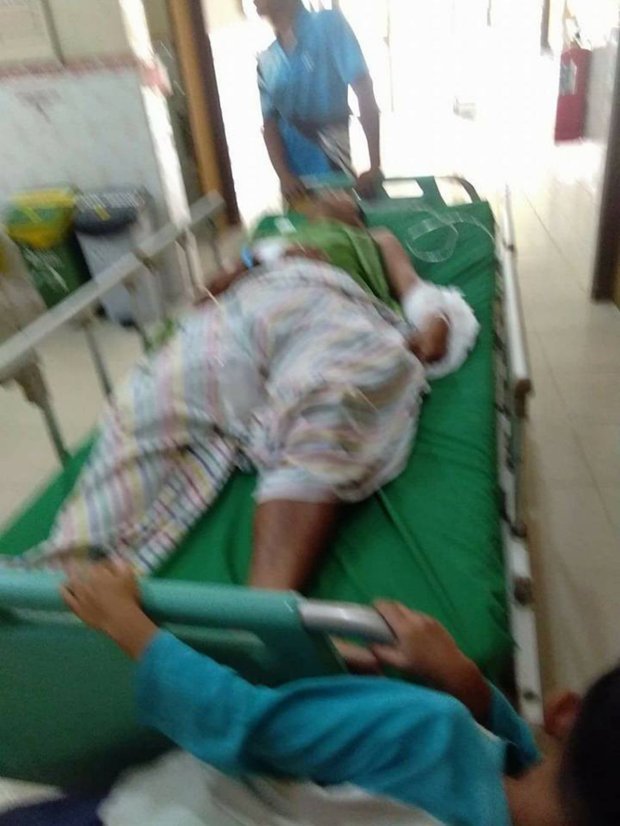 Pic shows: Robert Nababan in a hospital bed.

A man is recovering in hospital after winning a fight to the death with a 23-foot python.

Brave Robert Nababan says he came across the huge reptile on a road on his way home from work in the Indragiri Hulu Regency of Riau Province in north-western Indonesia.

The 37-year-old was riding his moped home from his job as a security guard on a palm oil plantation when he saw two pedestrians blocked from crossing the road by the giant snake.

From his hospital bed, he related the story of how he had tried to get hold of the snake to move it.

He was quoted as saying: 