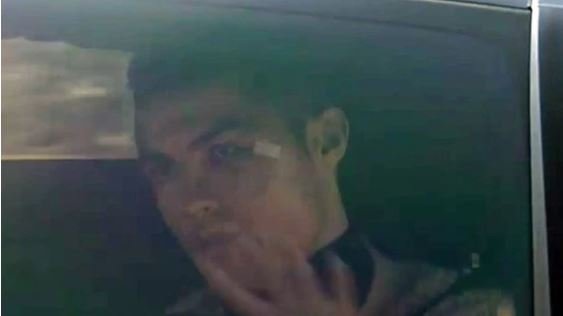 CR7 golpeado
