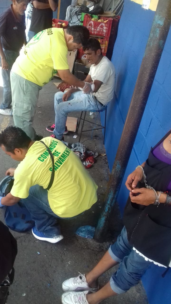 Agresión en la tiendona