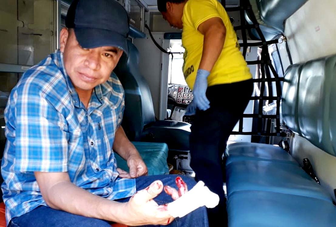 Naún Cárcamo atacado por un perro chow chow en Ciudad Delgado 3