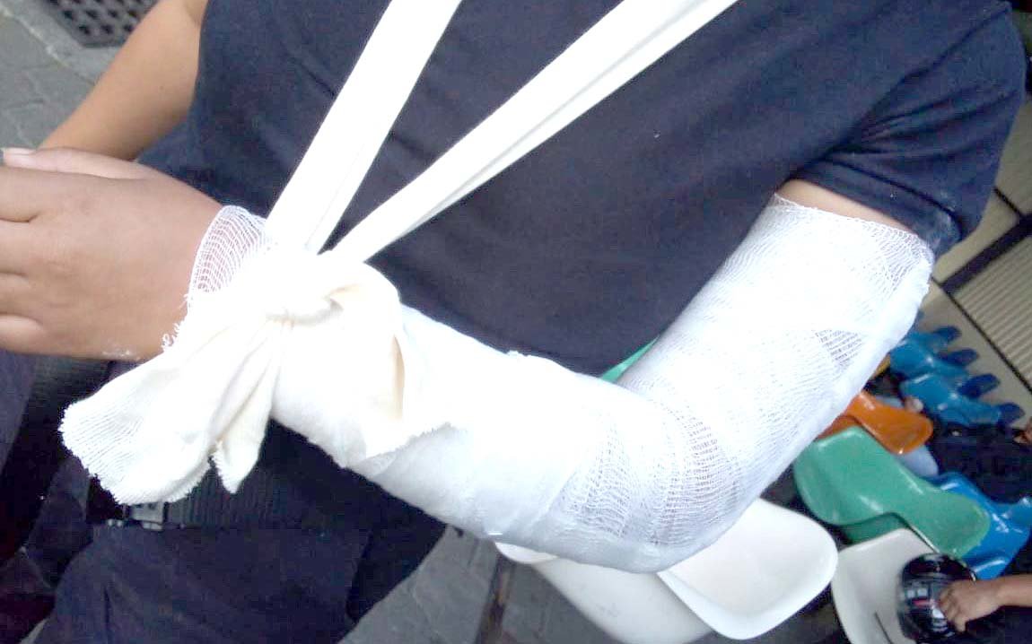 Detenido por arrollar a una policía en calle al Puerto 4