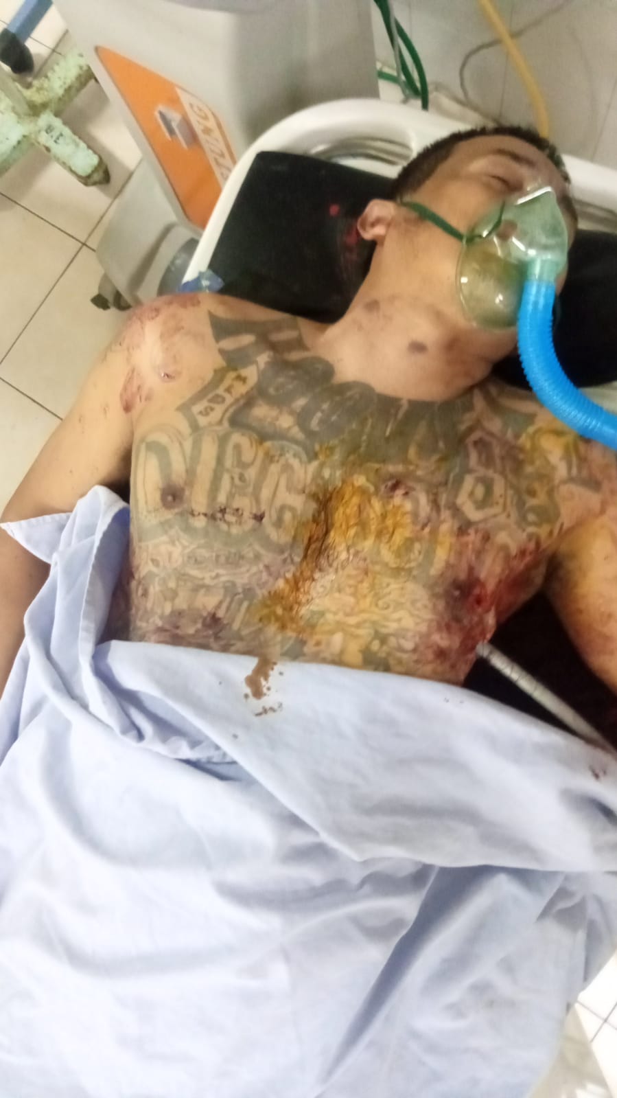 pandillero herido