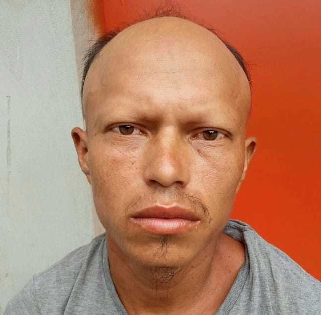 Elmis Arístides Vásquez Gómez intento de homicidio