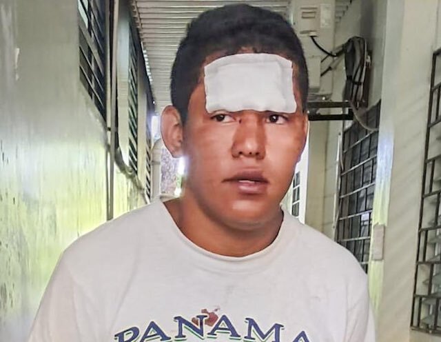 Roberto Antonio Beltrán Reyes, 24 años de edad, lesiones