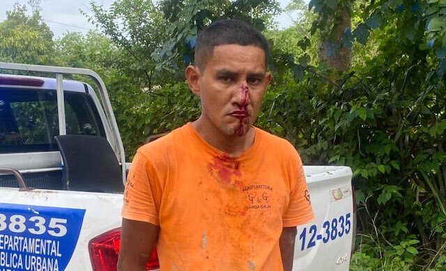 José Gabriel Buruca Portillo, 35 años de edad, lesiones culposas y conducción peligrosa