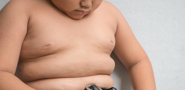 Obesidad infantil